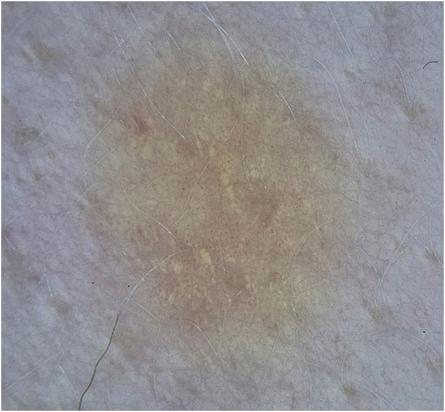 fig0010