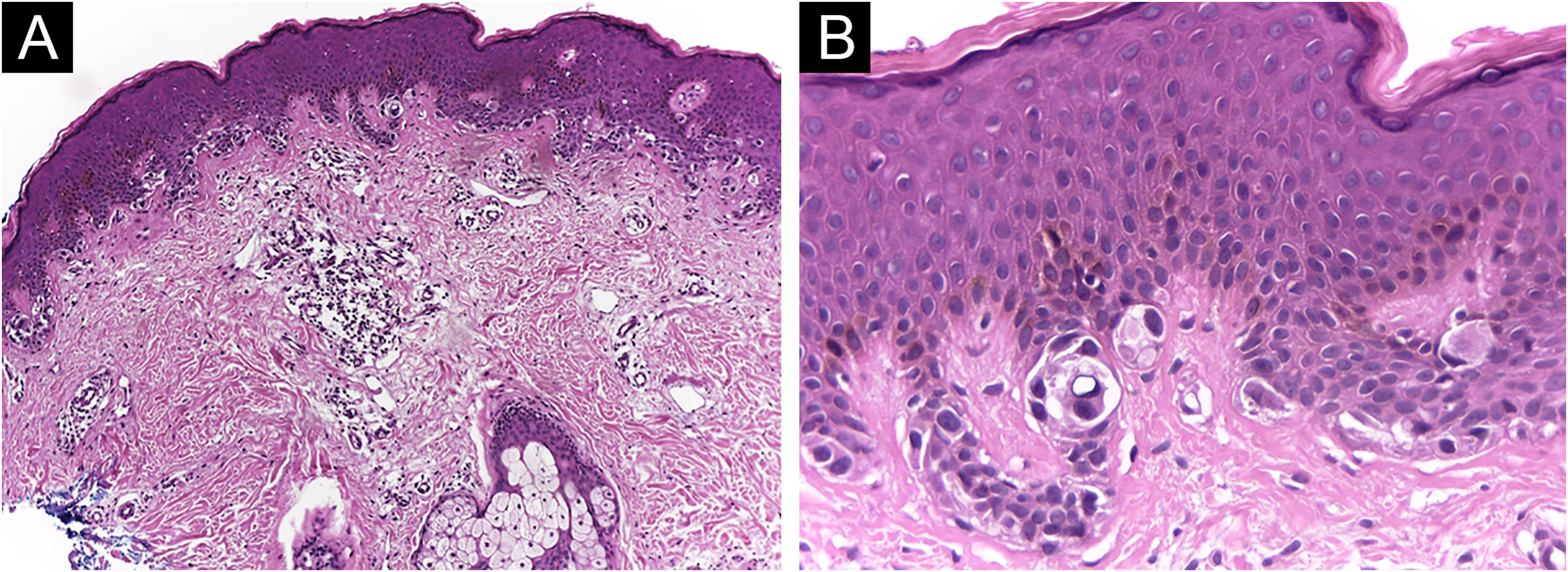 fig0005