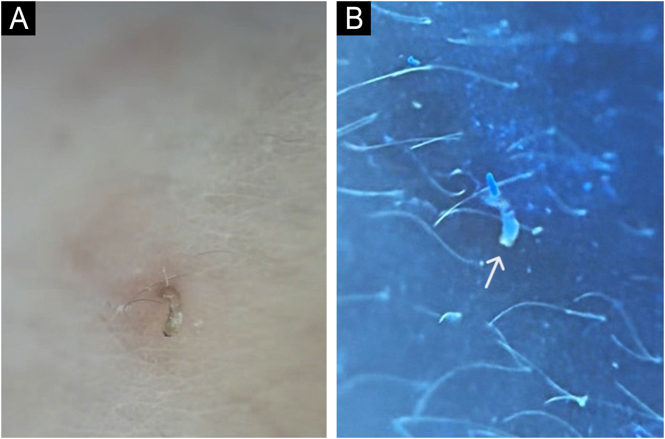 fig0010