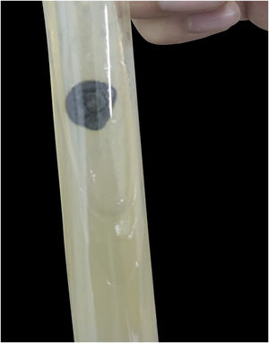 Culture for Sporothrix sp. at 25°, after 6 weeks.
