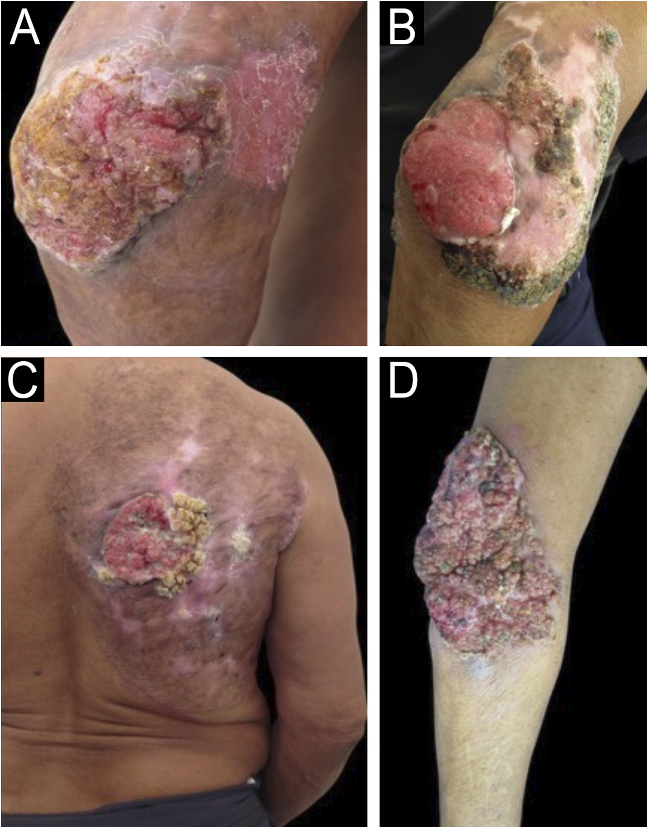fig0025