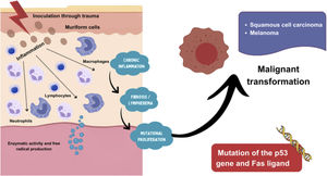 Pathophysiological scheme of malignant transformation. The development of malignant lesions arising in chromoblastomycosis scars involves chronic inflammation driven by neutrophils and macrophages, which release enzymes and free radicals capable of inducing mutagenic damage to the p53 tumor suppressor gene and the Fas ligand, thereby promoting malignant transformation.