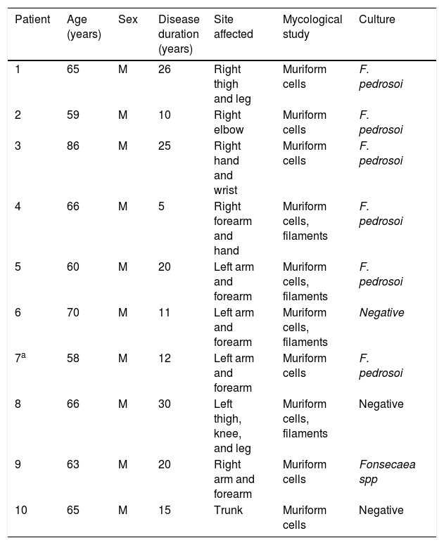 Tables