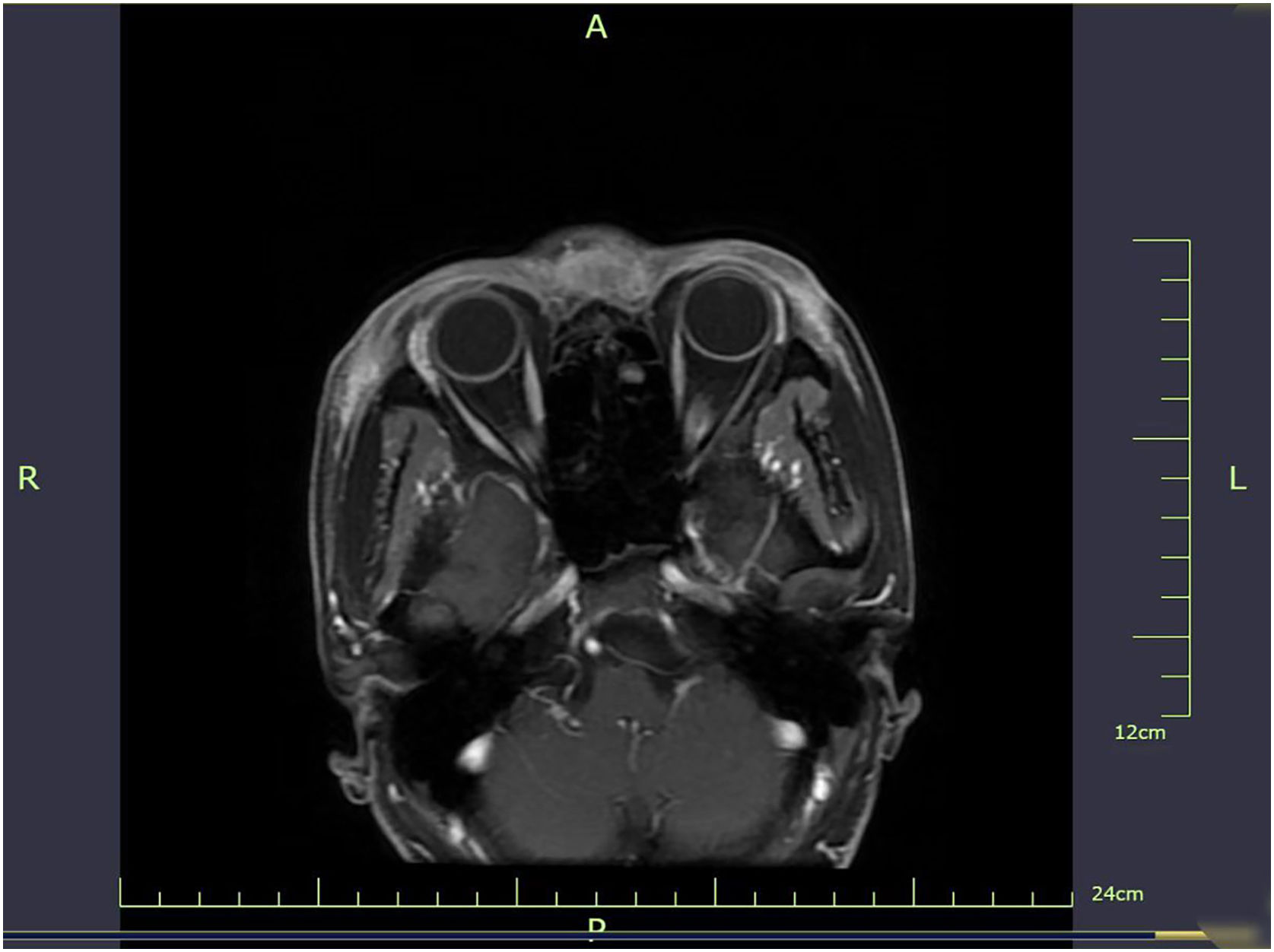 fig0010