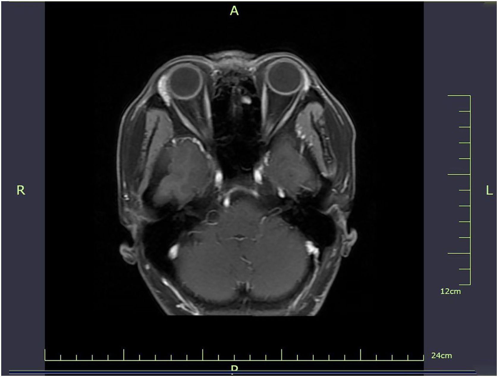 fig0020