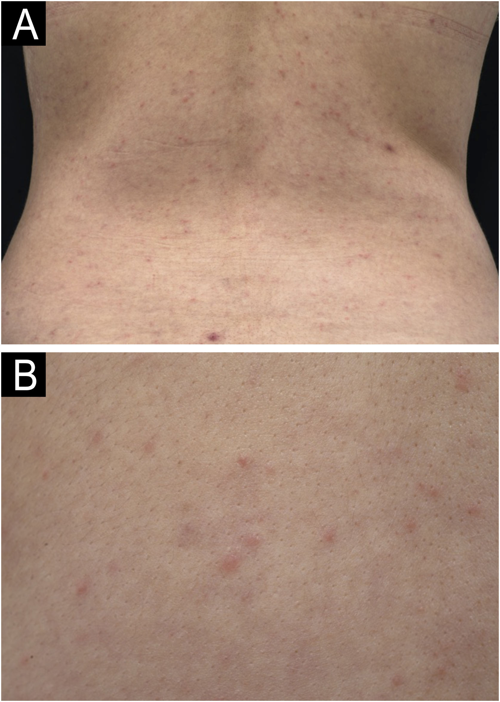 fig0005