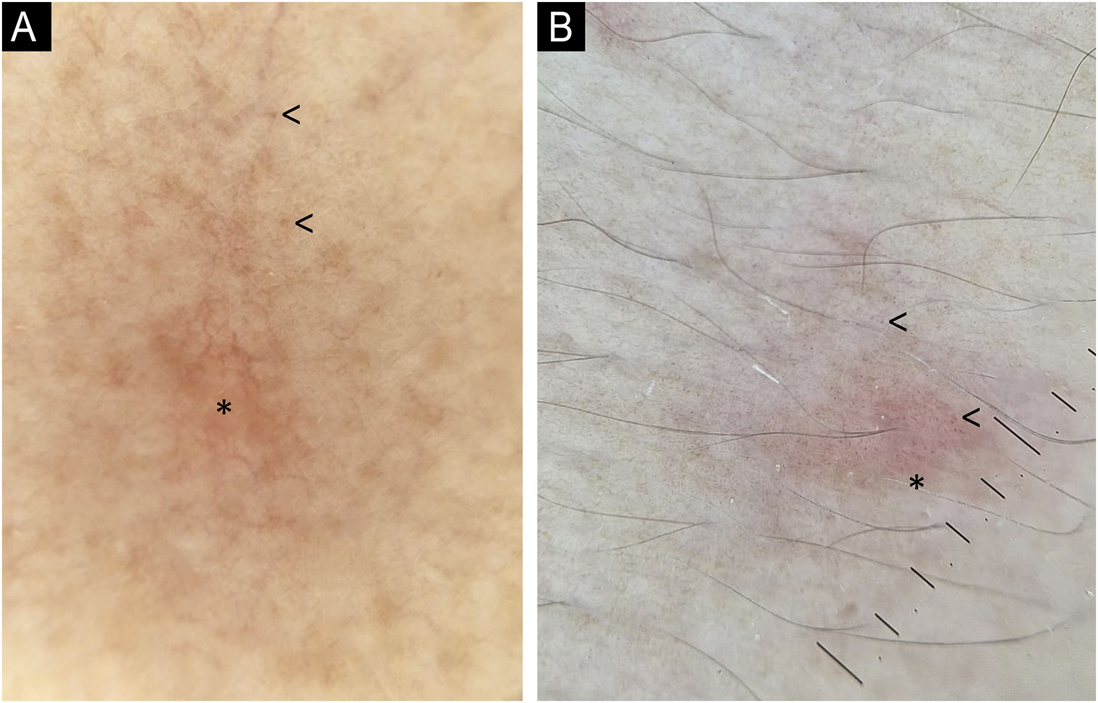 fig0015