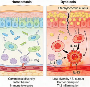 Mechanistic transition from cutaneous homeostasis to dysbiosis. Under homeostatic conditions (left), high commensal diversity maintains an intact barrier and immune tolerance. In dysbiosis (right), typical of atopic dermatitis, colonization by Staphylococcus aureus leads to barrier disruption and activation of Th2-mediated inflammatory pathways (IL-4, IL-13). Created in https://BioRender.com