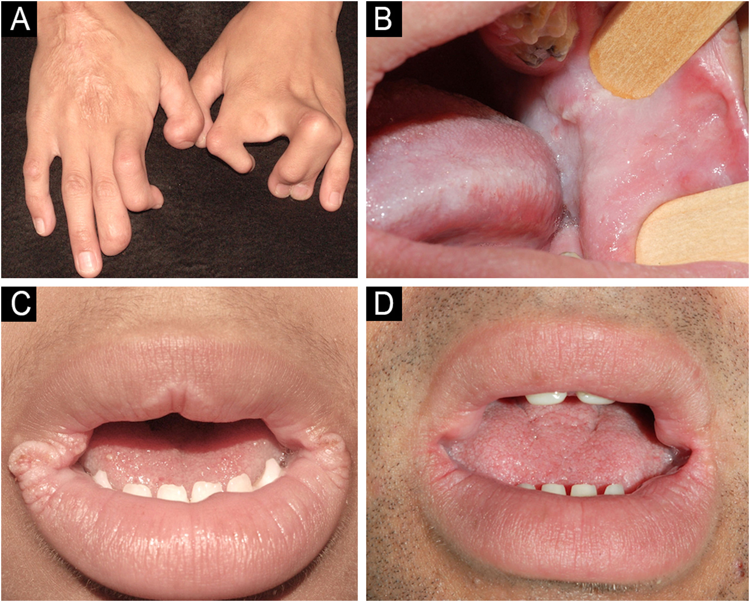 fig0005