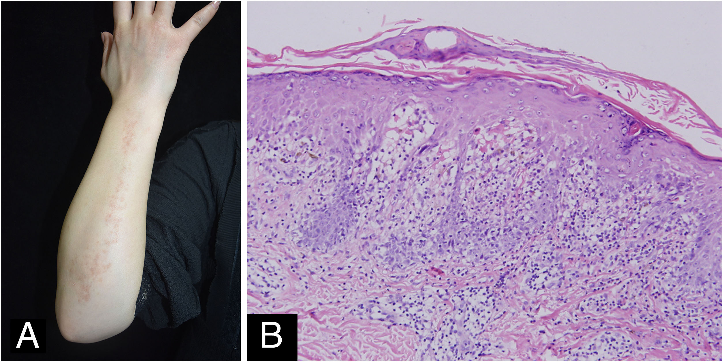 fig0010