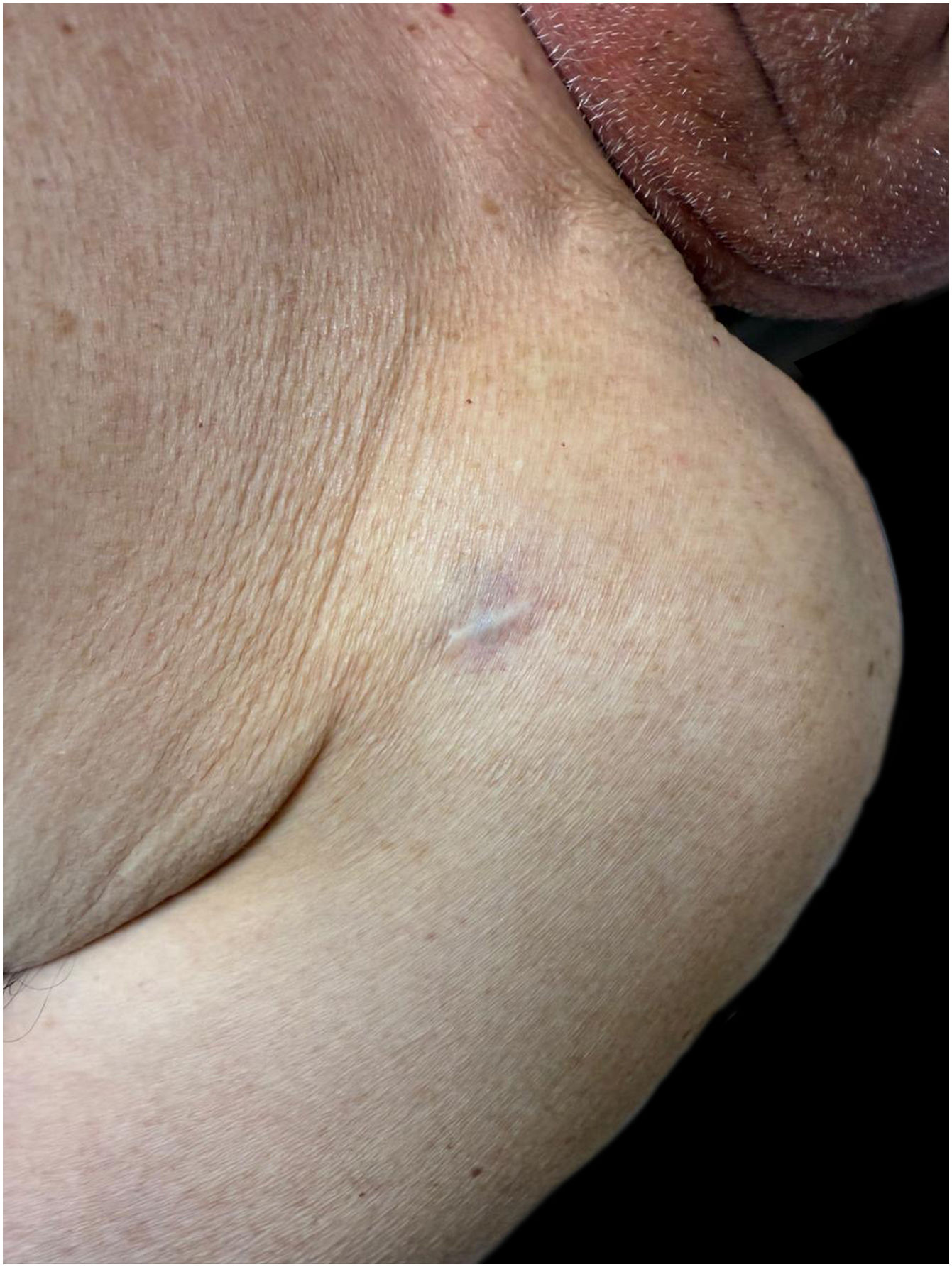 fig0005