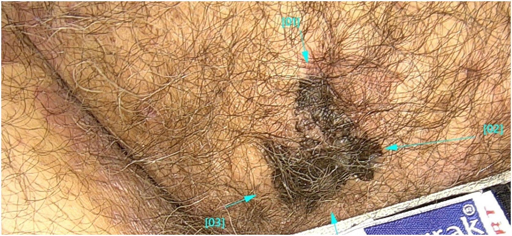 fig0005