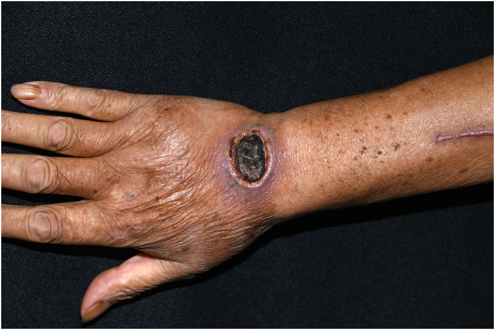 fig0005