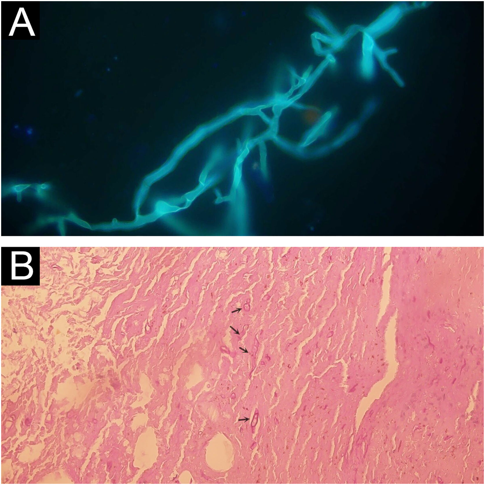 fig0010