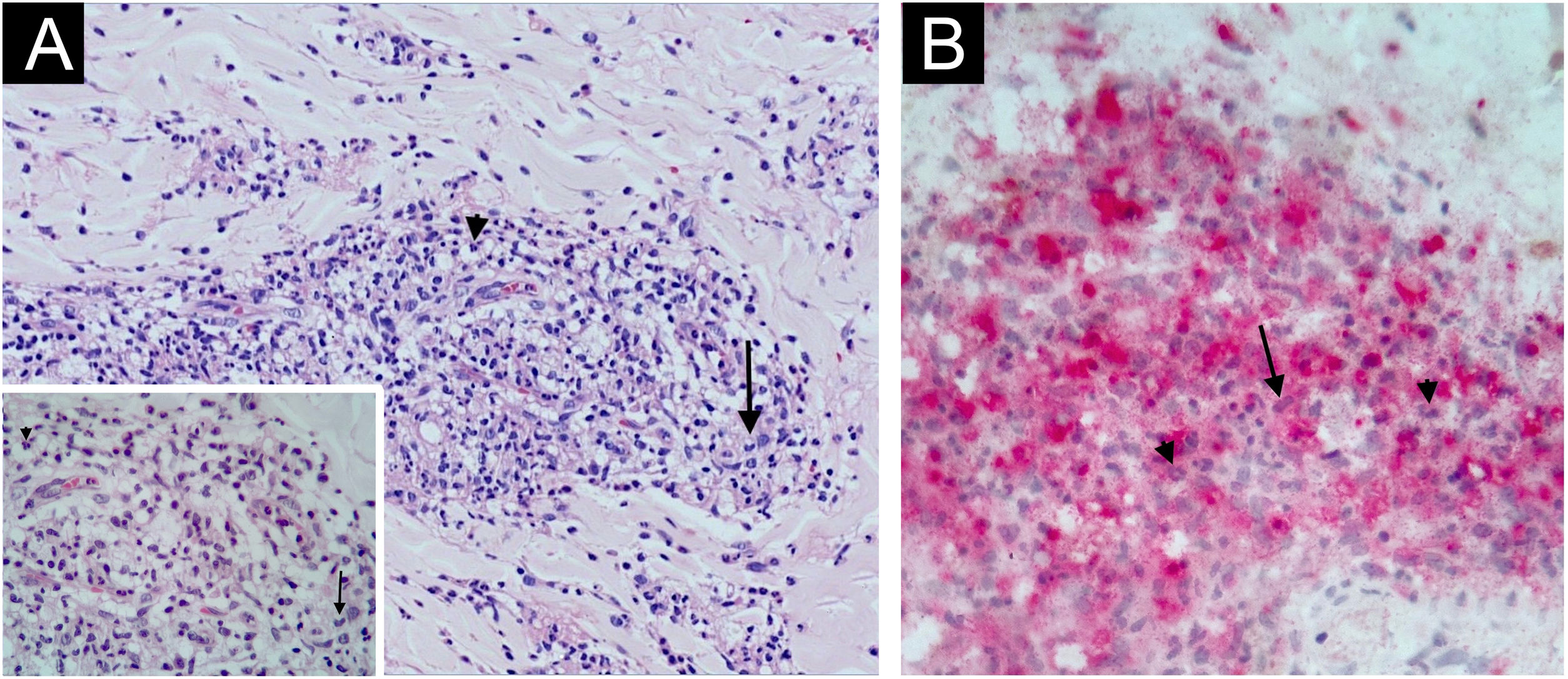 fig0015