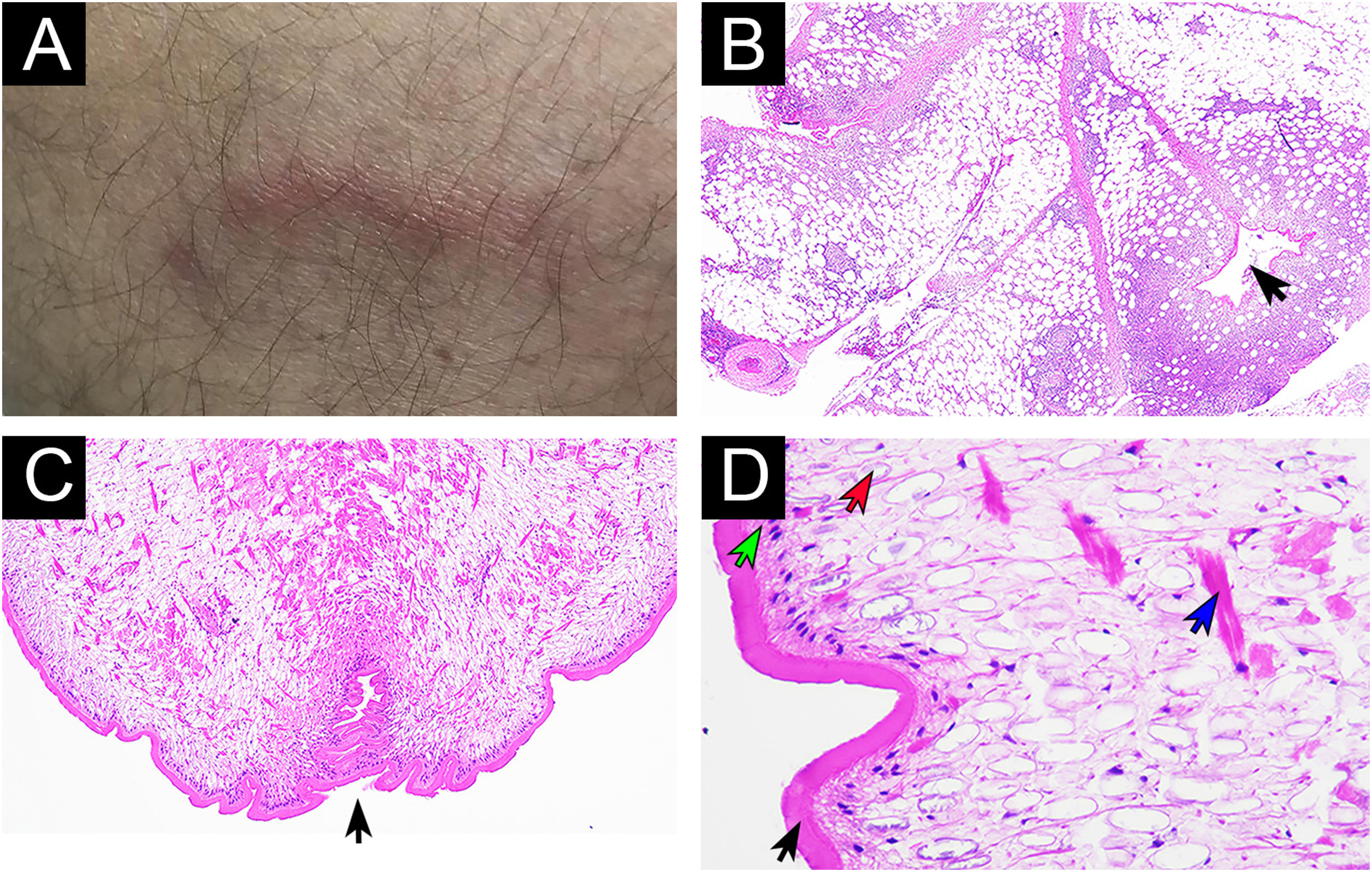 fig0010