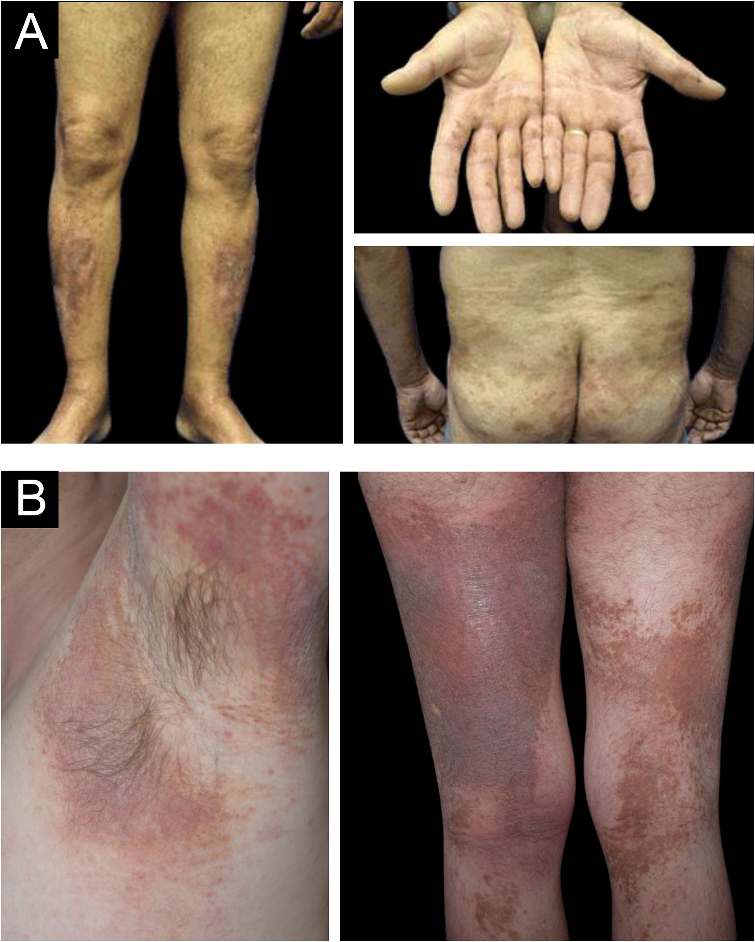 fig0015