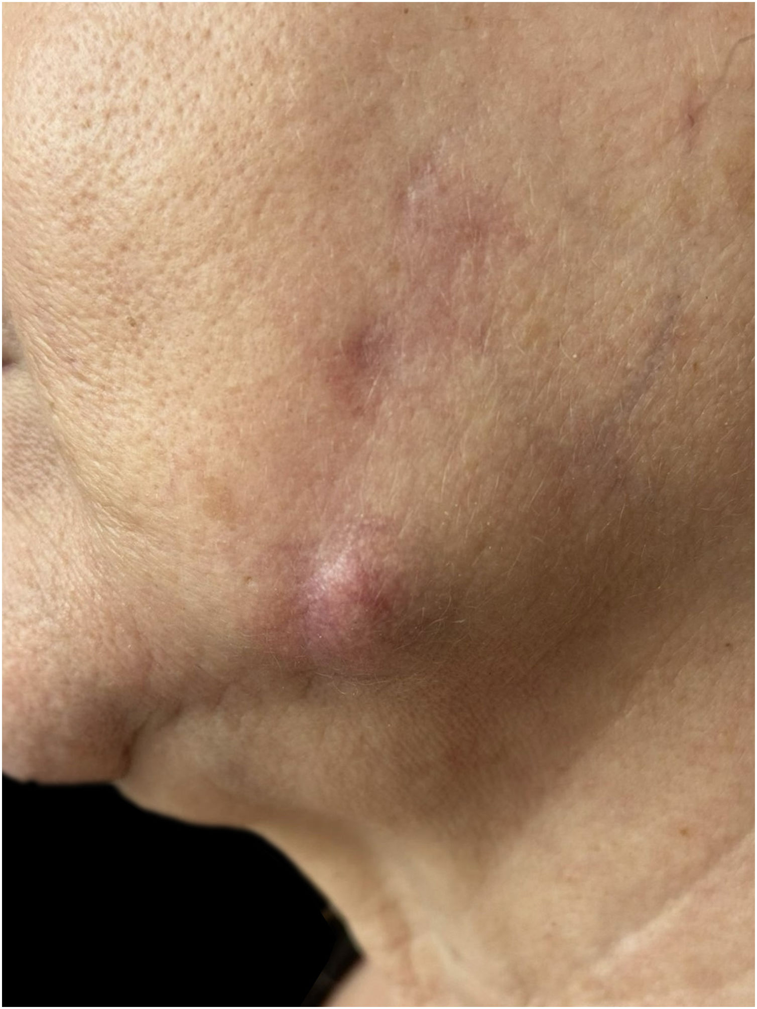 fig0005