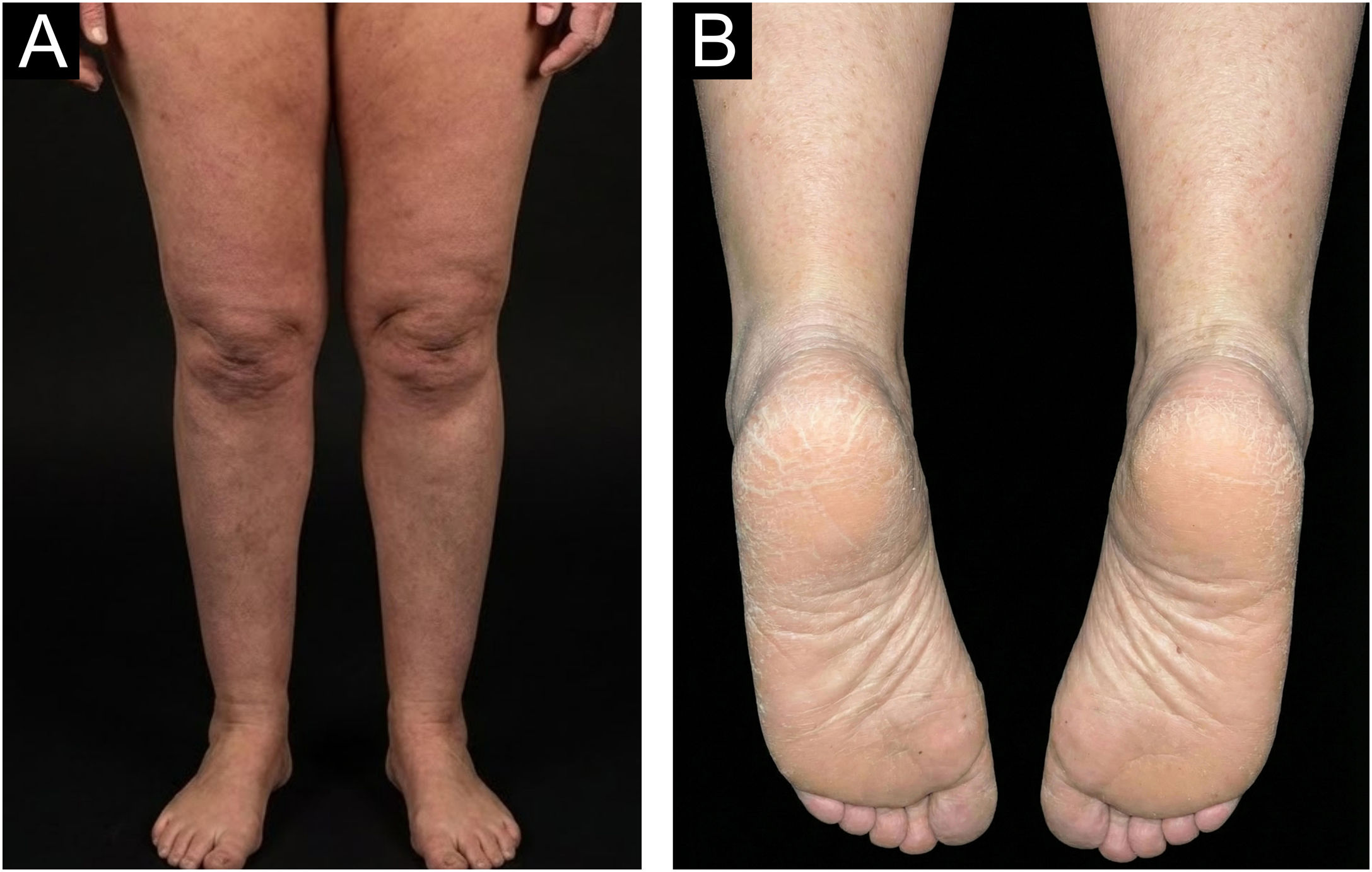 fig0010