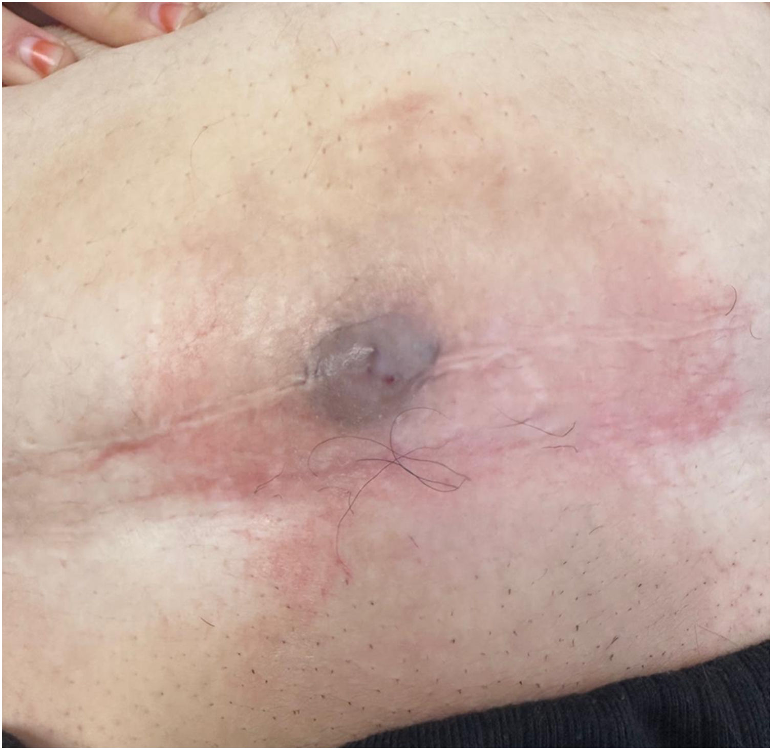 fig0005