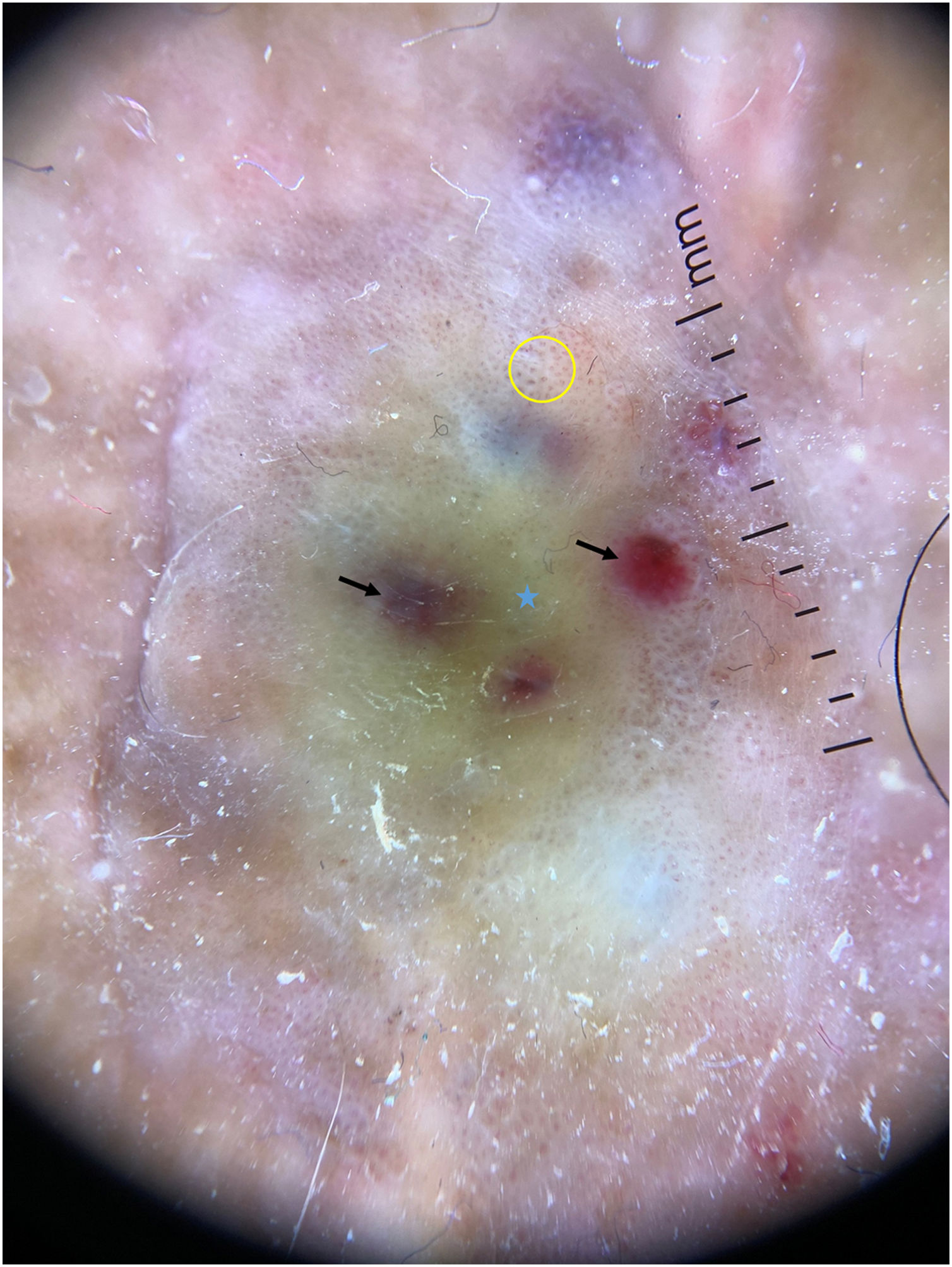 fig0010