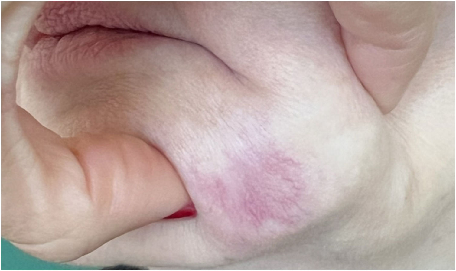 fig0005