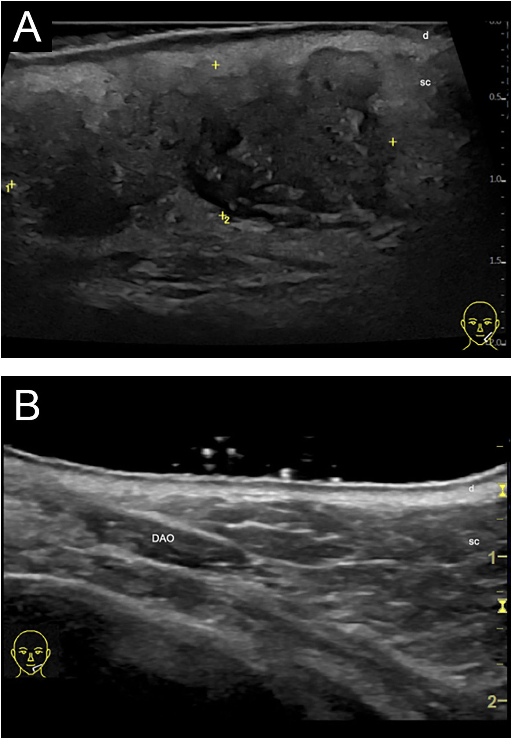 fig0015