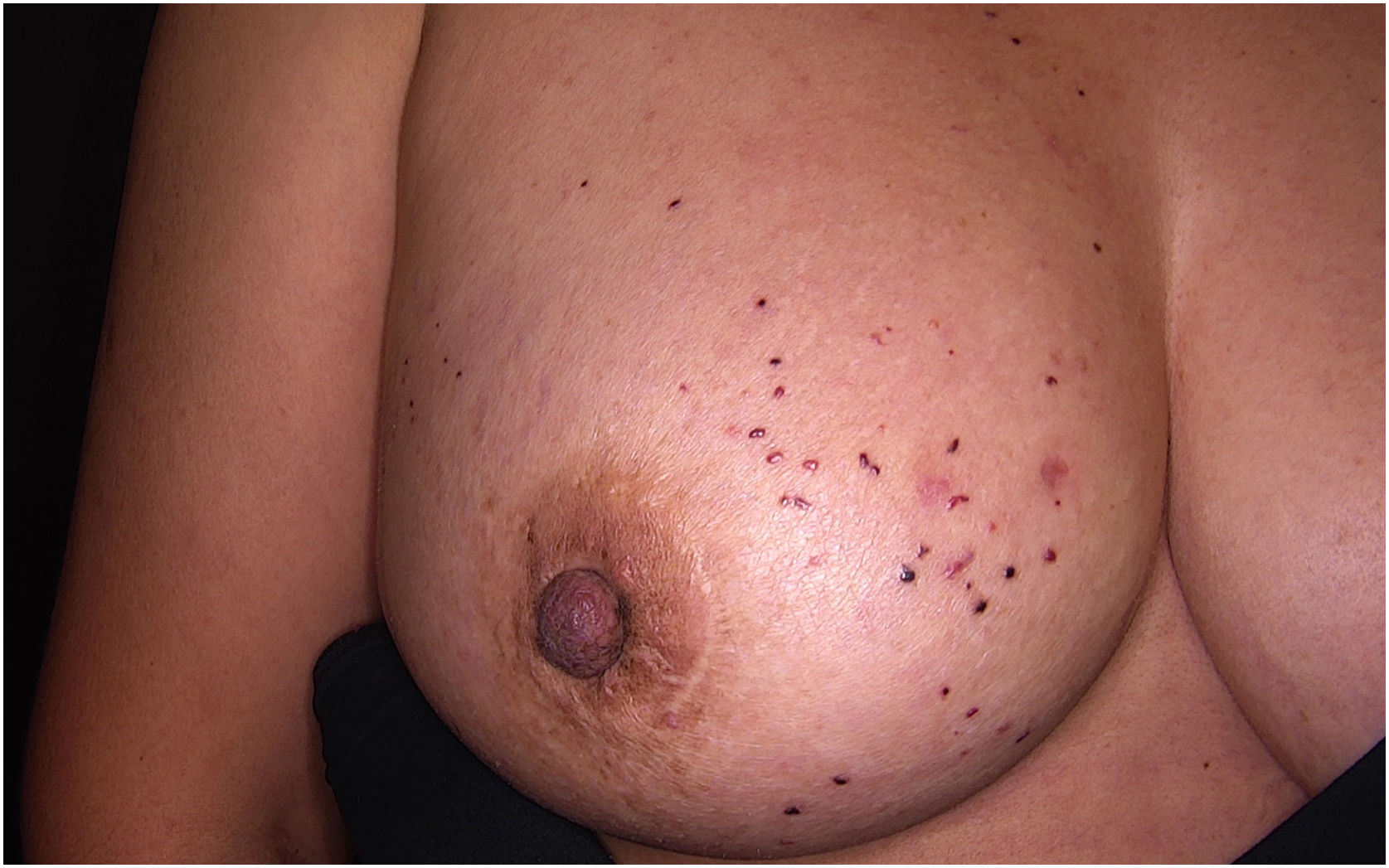 fig0005