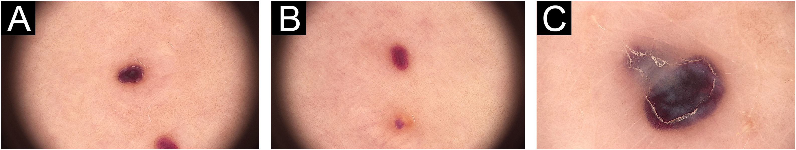 fig0010