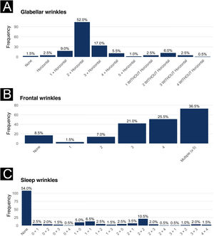 Wrinkle pattern – (A) Glabella – the most frequent pattern was two vertical wrinkles with a horizontal component (52%), followed by three vertical wrinkles with a horizontal wrinkle (17%). (B) Forehead – the majority of patients had more than five horizontal forehead wrinkles (36.5%). (C) Sleep wrinkles – the most common pattern was two wrinkles on each side (10.5%), followed by one on each side (6.5%).