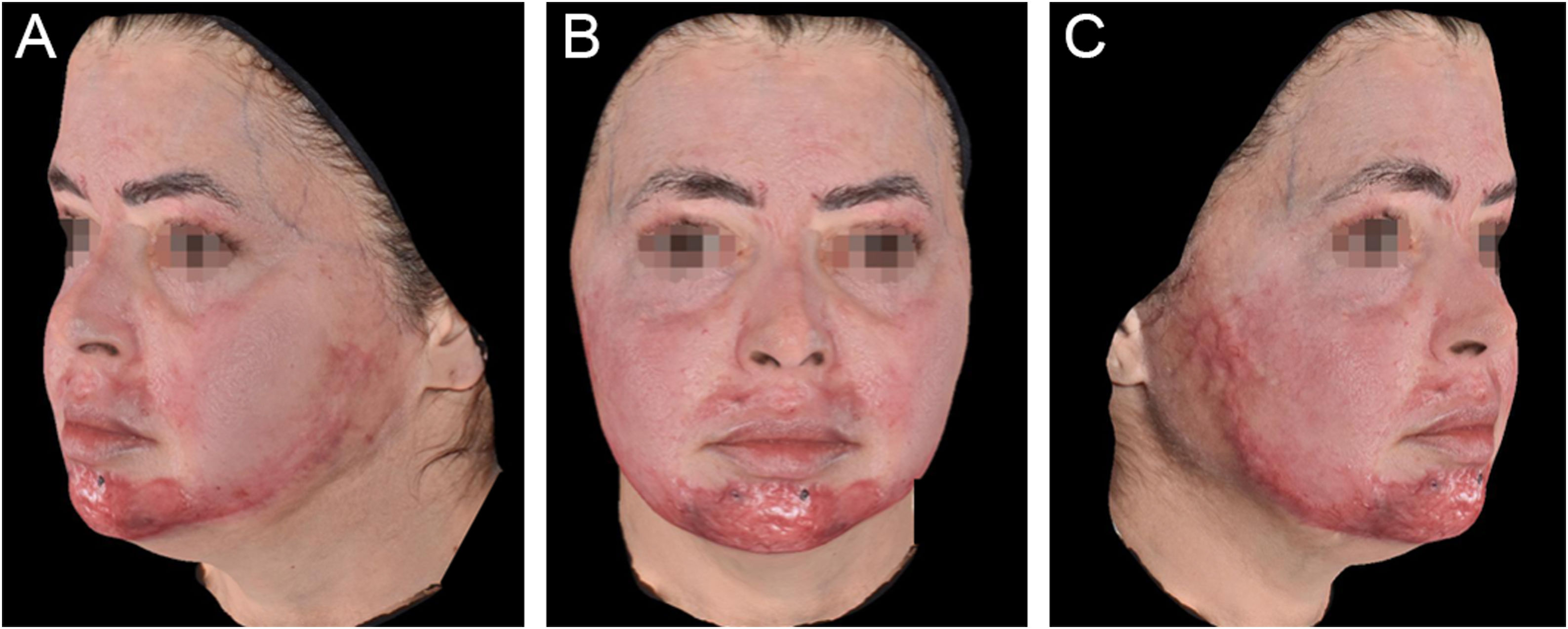 fig0010