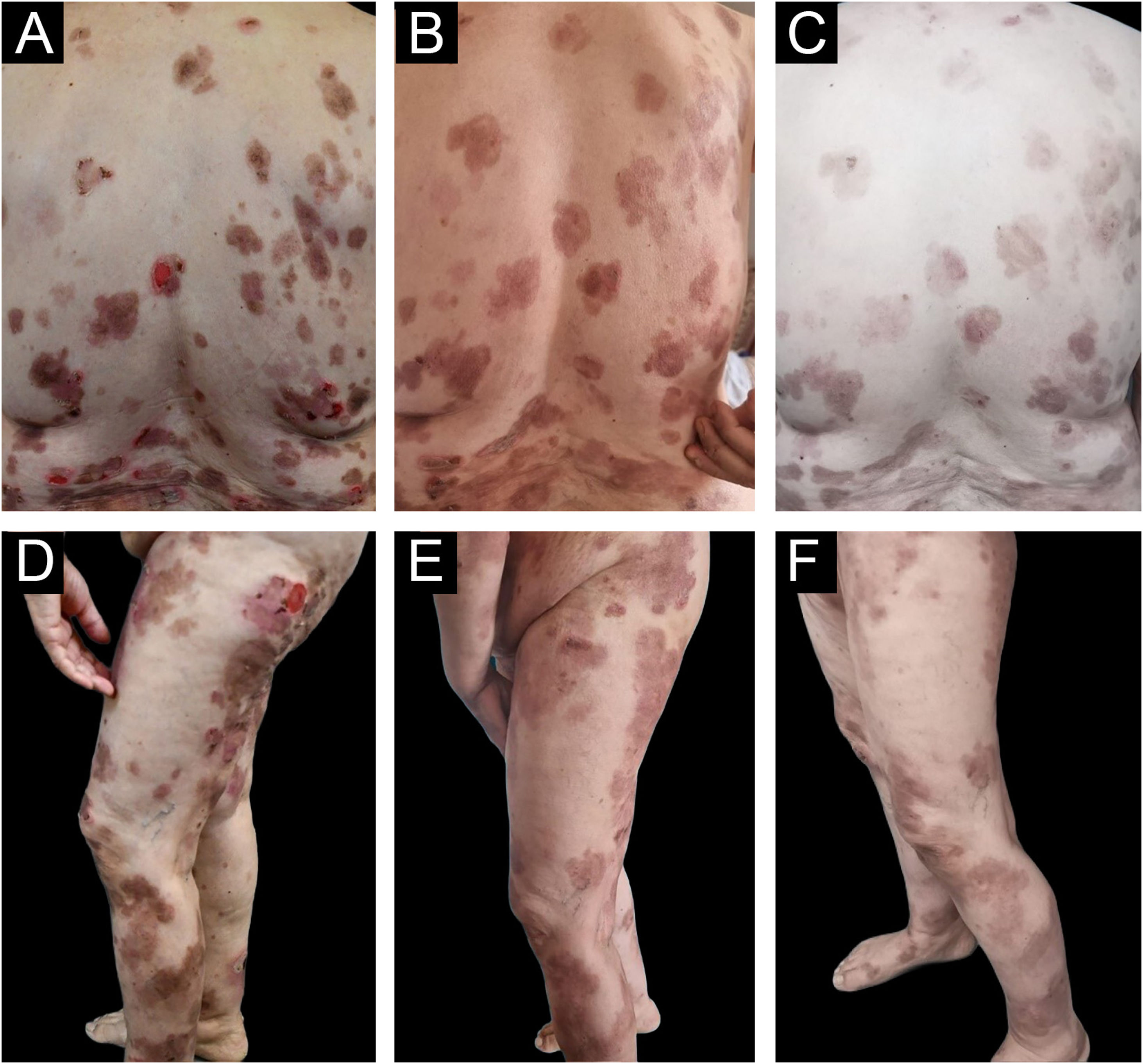 fig0005