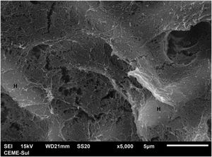 SEM – high magnification in the compact area, depicting hyphae (H) embedded in micro fibrillar matrix (×5.000).