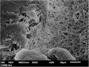 Scanning electron microscopy (SEM) - low magnification viewing the colony with filamentous area on the right and compact area on the left (×300).