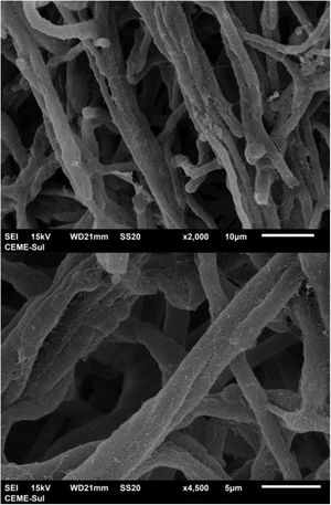 SEM ‒ adhered and parallel hyphae (×2,000 and ×4,500).