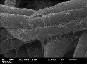 SEM ‒ high magnification with detail of the adhesion and parallel arrangement of hyphae (×11.000).