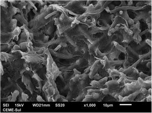 SEM – low magnification in the compact area, showing fungal structures embedded in dense extracellular matrix (×1.000).