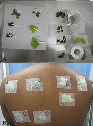 (A) Preparation of leaves with bidistilled water for the prick-by-prick test on the left and contact test on the right. (B) Application of leaves for the contact test identified by letters: (A) Coriander; (B) Chives; (C) Parsley; (D) Watercress; (E) Iceberg lettuce stem; (F) Iceberg lettuce leaf; (G) Leaf and stem of green-leaf lettuce.