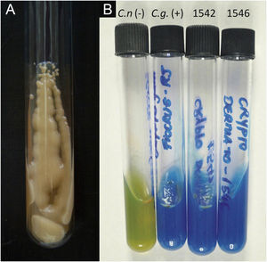 PCC: (A) Cryptococcus spp. Yeast culture; appearance of condensed milk. (B) Cryptococcus neoformans and C. gattii. CGB Agar. Yellowish-green tube, original CGB agar– C. neoformans. Cobalt blue tube, modified CGB agar – C. gattii.