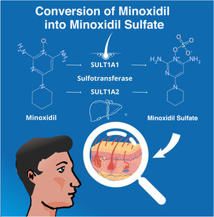 Conversion of Minoxidil into its active form, Minoxidil Sulfate.