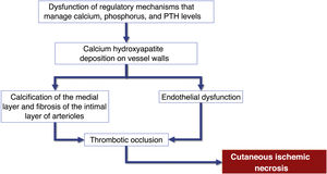 Flowchart of the sequence of events related to the pathophysiology of calciphylaxis: calcification of arterioles, endothelial lesion and consequent thrombotic occlusion of these vessels. These alterations cause ischemia and necrosis of the subcutaneous tissue, with the appearance of necrotic ulcers in the most advanced stages. PTH, Parathyroid hormone.