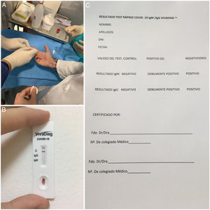 A) Fotografía del momento de obtención de una muestra de sangre total capilar en la yema del dedo índice. B) Resultado negativo de un test rápido realizado a uno de los oftalmólogos de nuestro servicio. C) Informe de certificación del resultado de la prueba diagnóstica.