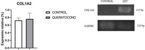 Expresión génica de colágeno I en el modelo animal de queratocono. Aunque no hay cambios significativos, se observa una tendencia al incremento en la expresión de colágeno tipo I en el grupo con queratocono. Los datos se presentan como media+error estándar; n=6 por grupo. bp: pares de bases; COL1A2: colágeno tipo I cadena alfa 2; QTC: queratocono.
