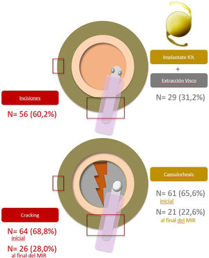 A. Primer paso de la facoemulsificación que se aprende. Incisiones (principal y paracentesis) son las más citadas, seguidas de la implantación de la lente y extracción del viscoelástico. B. Maniobra más difícil para aprender. Al principio de la residencia, el cracking fue el que se citó con mayor frecuencia. Al finalizar la residencia, si bien ambas maniobras son siempre percibidas como complicadas, el número de participantes que las citan se divide por tres.