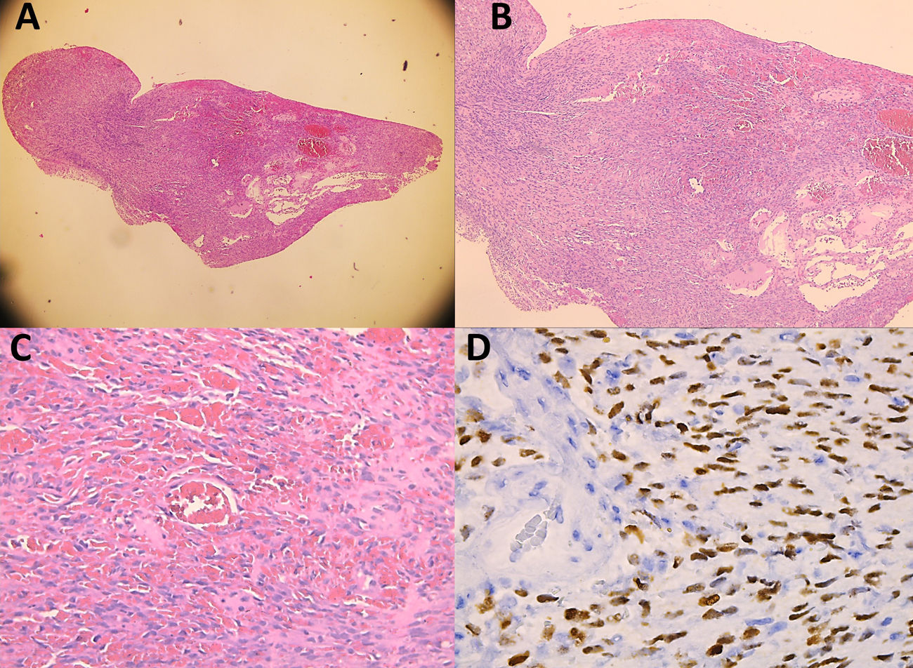 fig0010