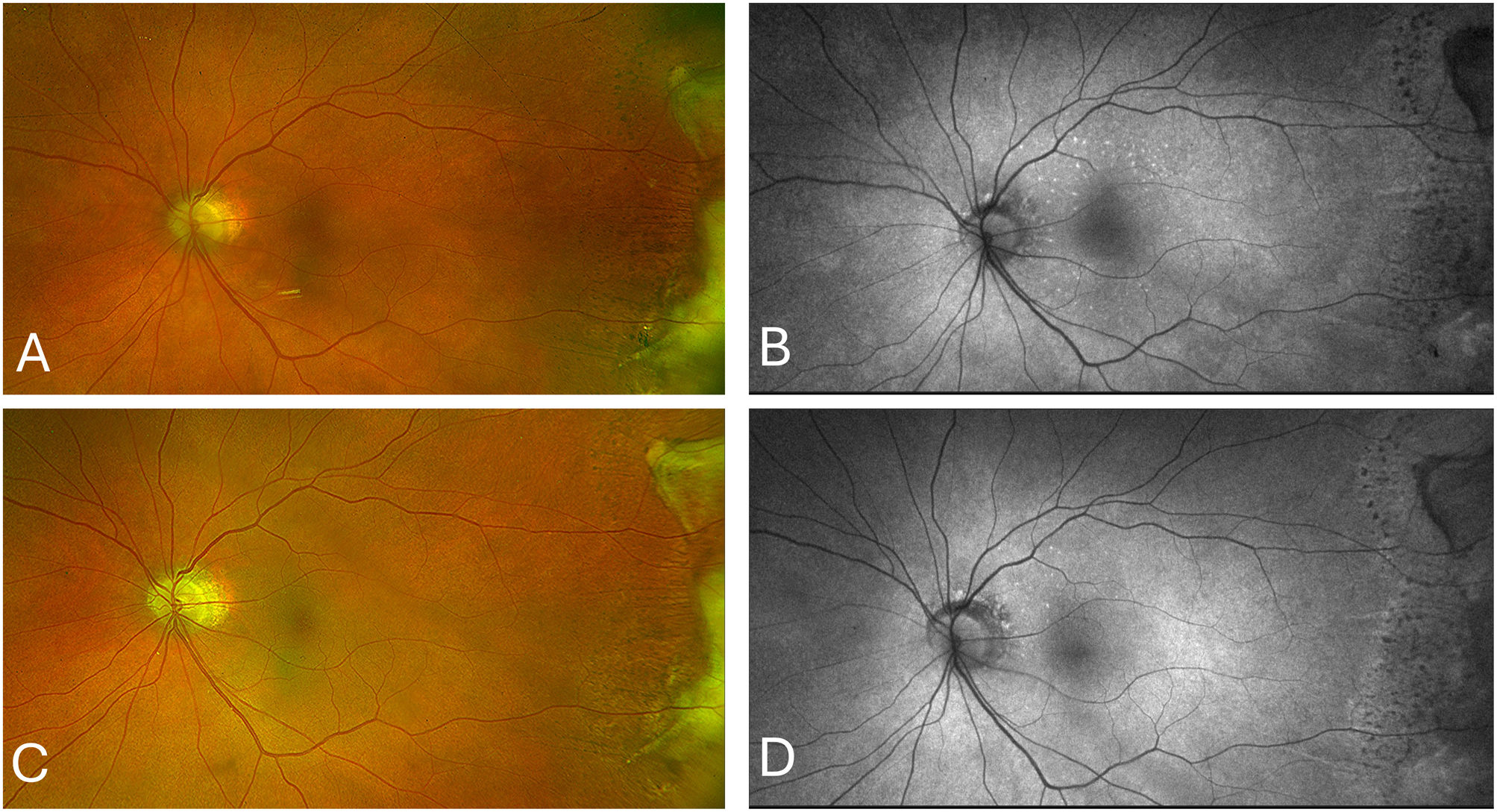 fig0010