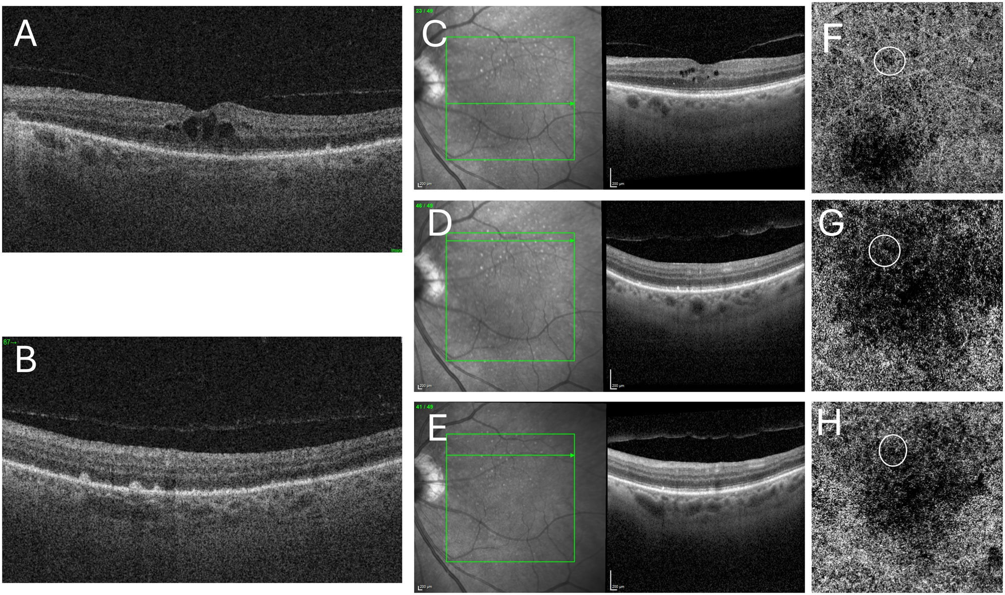 fig0015