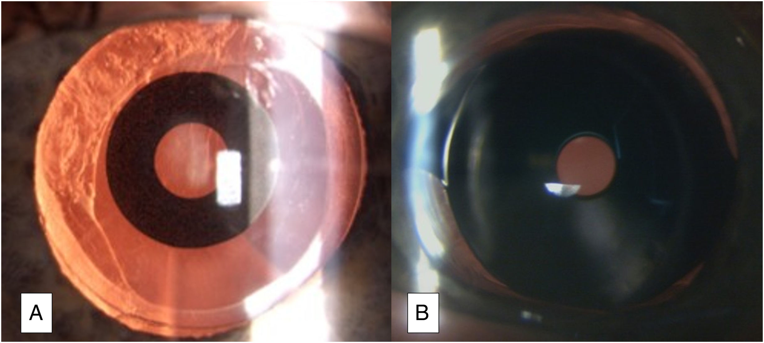 fig0010