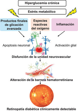 Cascada patogénica conducente a la retinopatía diabética clínicamente detectable. La hiperglucemia crónica inicia un estrés metabólico caracterizado por un aumento del estrés oxidativo, la acumulación de productos finales de glicación avanzada, la activación de la proteína cinasa C y una inflamación de bajo grado. Estos mecanismos alteran la unidad neurovascular retiniana y provocan disfunción neuronal temprana, gliosis de las células de Müller y activación microglial, junto con deterioro del acoplamiento neurovascular. La pérdida progresiva de pericitos y el daño endotelial causan una alteración de la barrera hematorretiniana y disfunción capilar. Posteriormente, la hipoxia retiniana favorece el aumento de la expresión del factor de crecimiento endotelial vascular (VEGF), lo que finalmente da lugar a los signos clínicos de la RD, incluidas las fases no proliferativa y proliferativa.