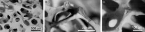 SEM micrographs of a HA scaffold obtained by replication polymer method (A) interconnected macroporosity to allow cell colonization and vascularization and (B) and (C) detail of the cavities inside of scaffold generated by thermal decomposition of the polymer used as mold structure.